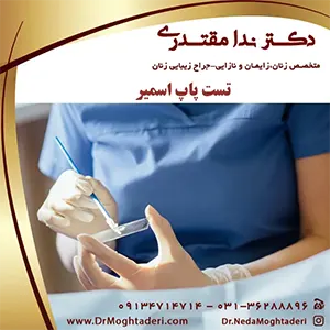 تست پاپ اسمیر در اصفهان