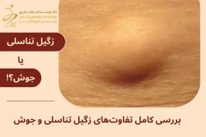 فرق زگیل تناسلی و جوش
