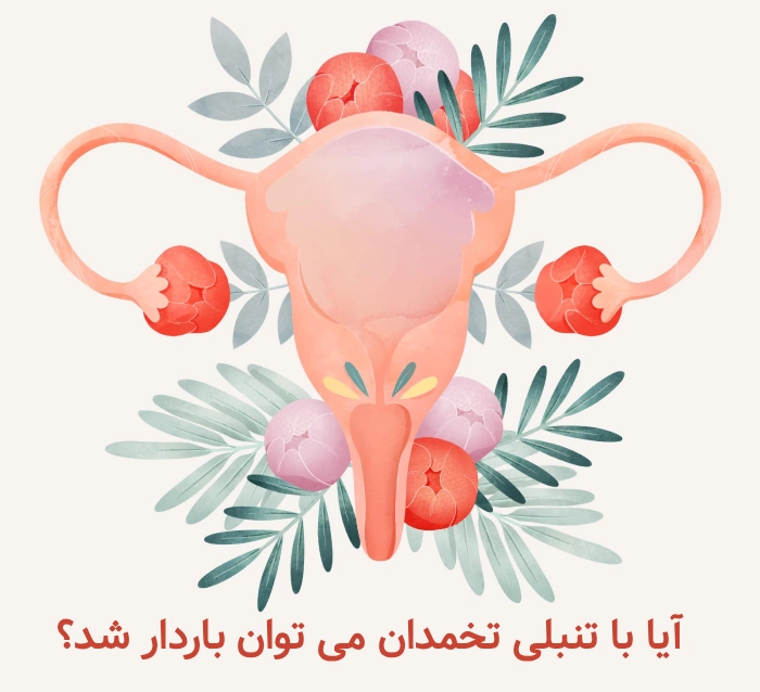 ارتباط تنبلی تخمدان و نازایی